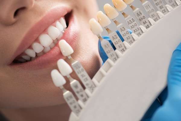 Featured image for “Understanding Dental Crowns at Cottonwood Dental”