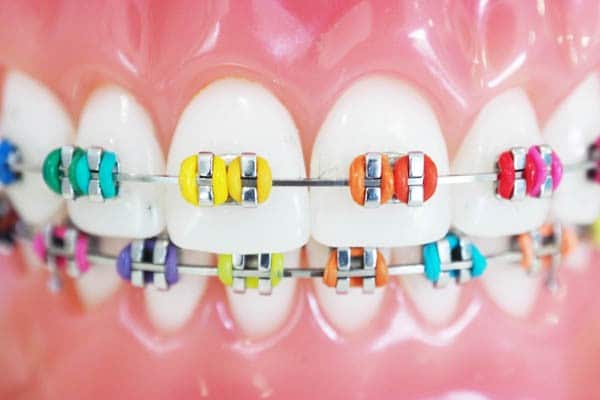 Featured image for “Innovative Clear Tray Orthodontics”