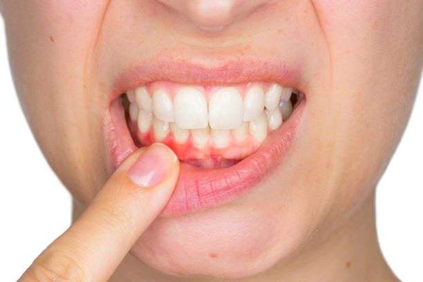 Featured image for “Your Gums and Your Health”