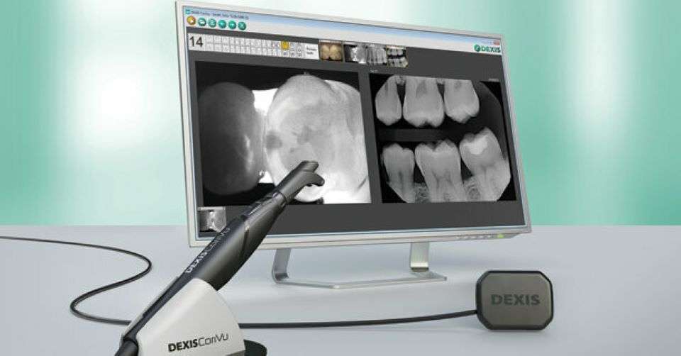 Featured image for “Our Highlands Ranch Dental Office Continues To Invest In Your Health With The CariVu Detector”