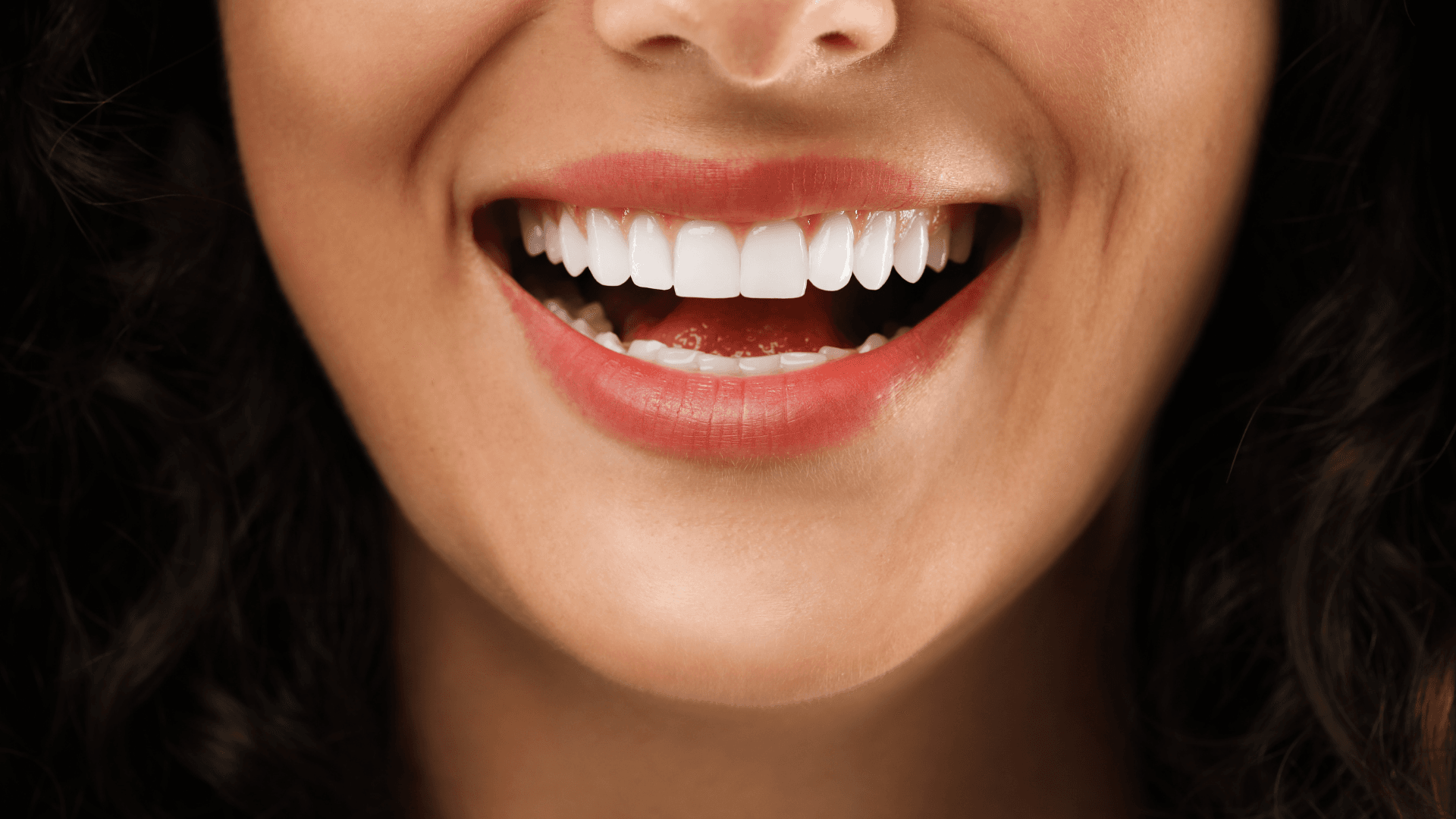 Featured image for “Porcelain Veneers Benefits”