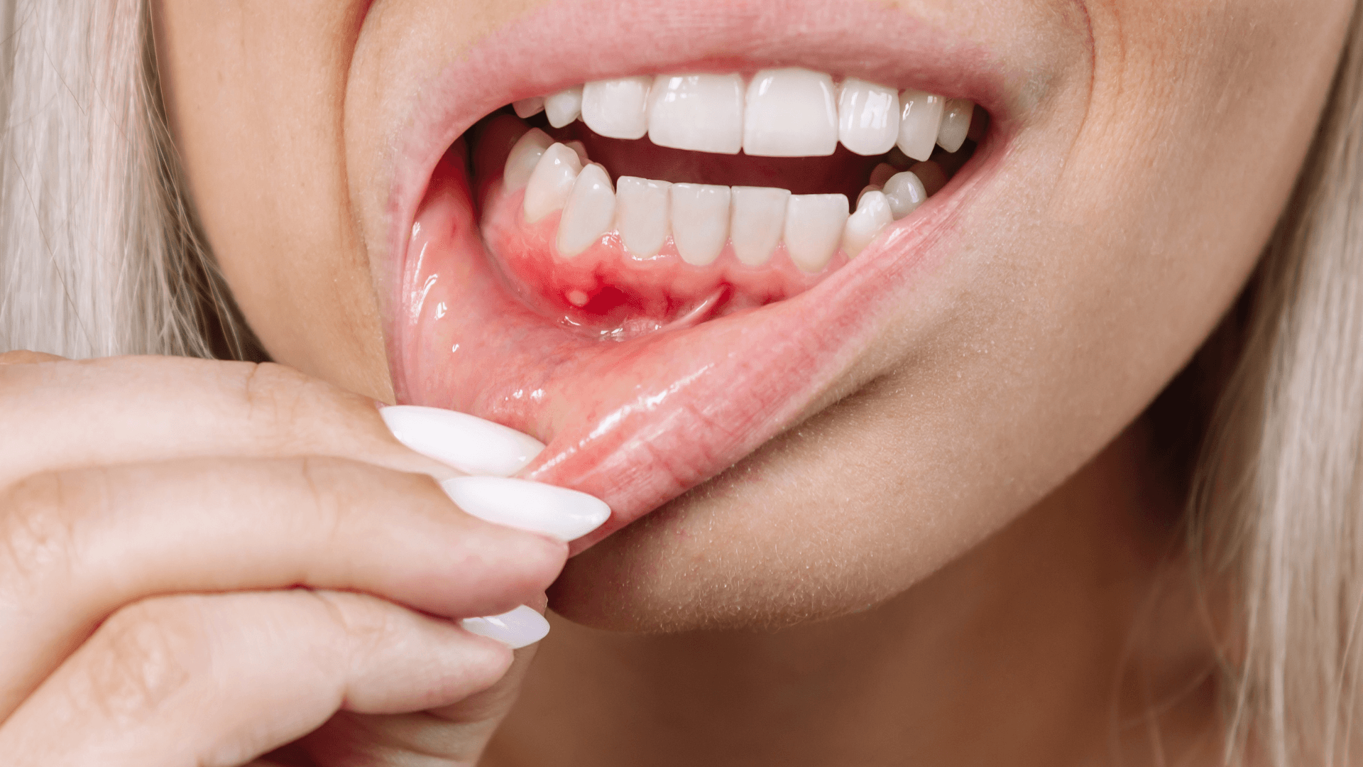 Featured image for “The Causes of Gum Disease and Ways to Prevent it”