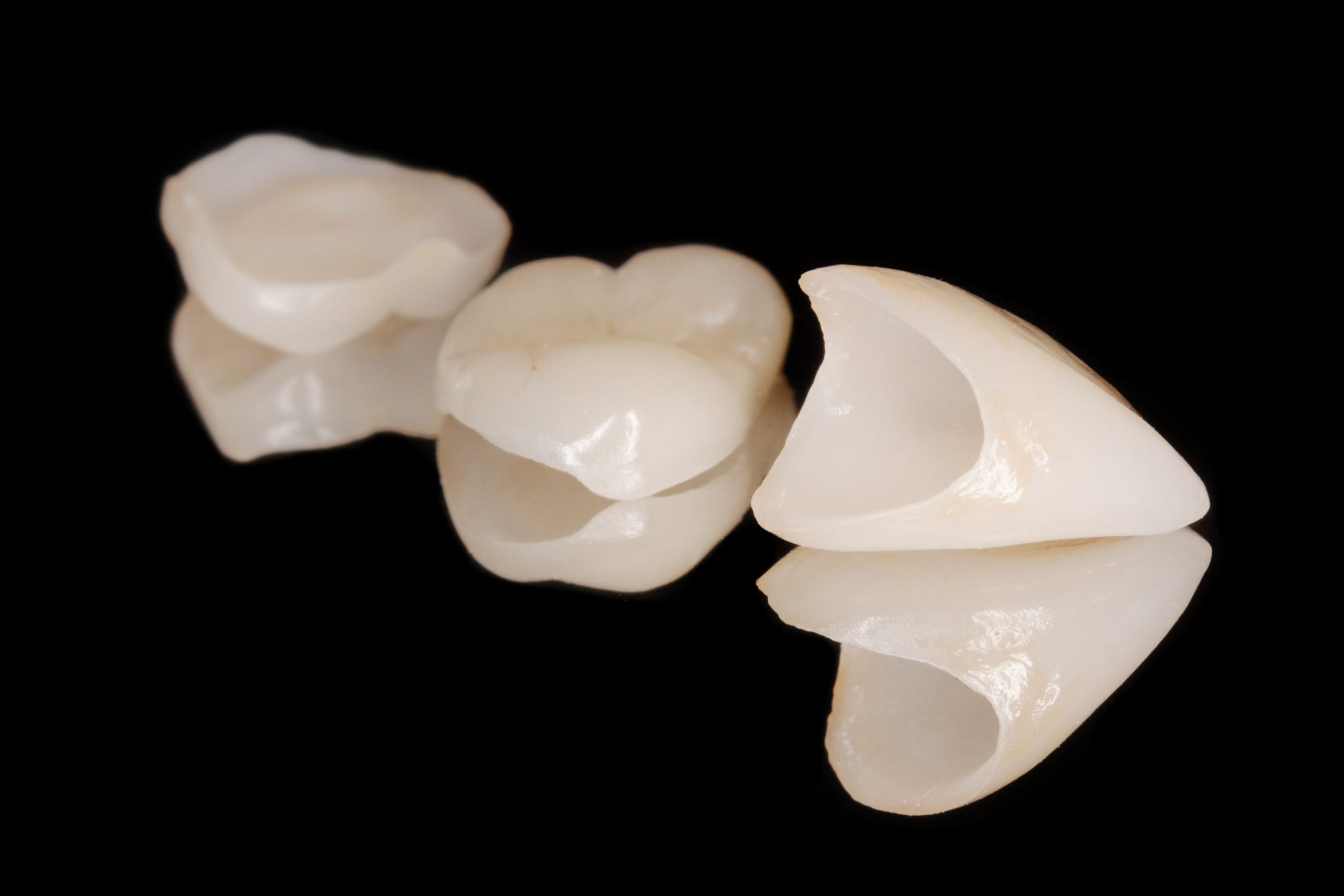 Highlands Ranch Dental Crowns